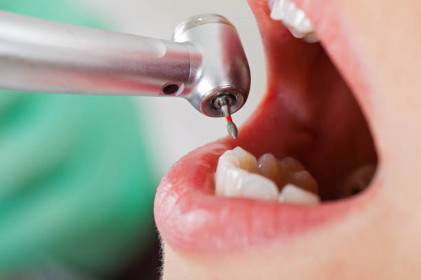 Best Cracked Tooth Emergency Dentist  in Balm, FL